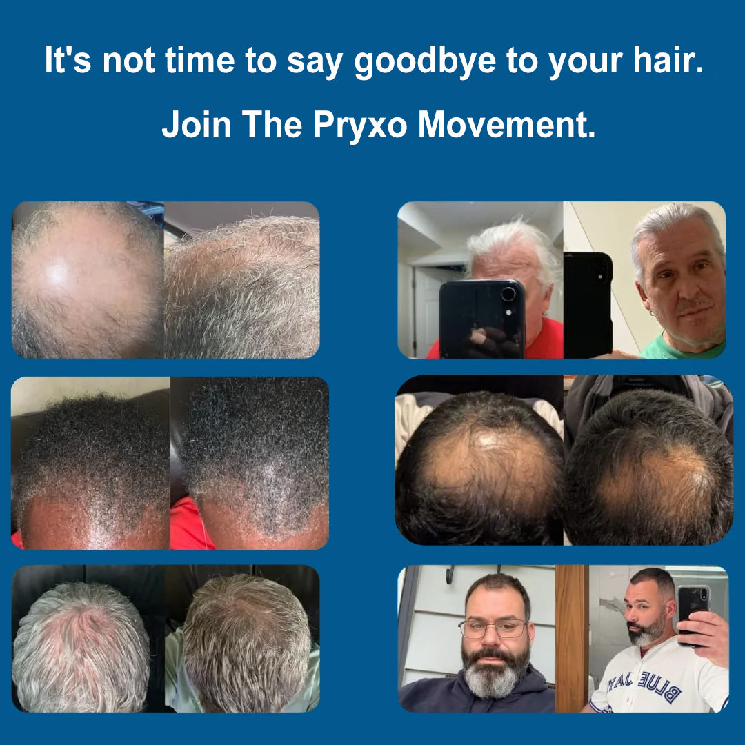 Micro-Infusion Peptide System For Hair Regrowth.