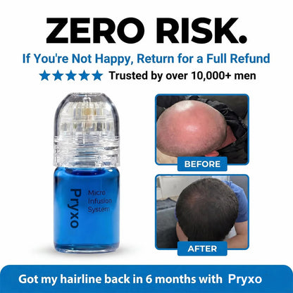 Micro-Infusion Peptide System For Hair Regrowth.